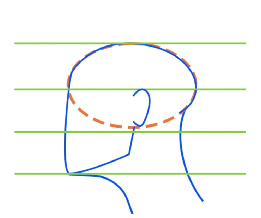 Profile view showing ear placement using thirds method and ear thickness