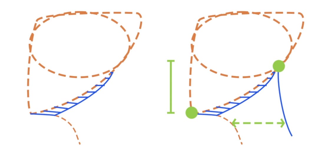 Diagram showing where neck connects to skull from profile, with back connection higher than front connection point