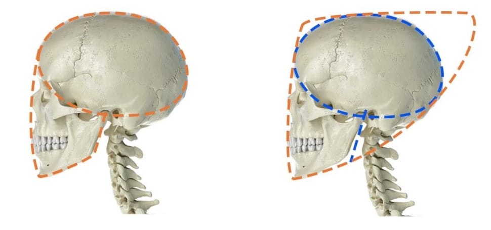 Skull profile drawing showing proportions with face longer than skull, and gesture arrows indicating skull moving back while face moves down